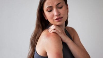 उन्हामुळे प्रचंड घामोळ्या येऊन खाज सुटतेय? ‘या’ आयुर्वेदिक उपायाने मिळेल आराम