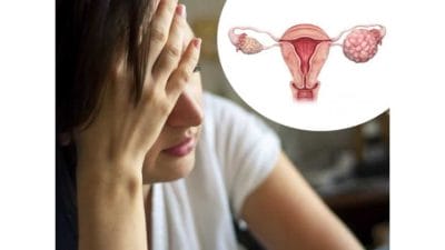PCOD म्हणजे काय? जाणून घ्या लक्षणे आणि घरगुती उपाय