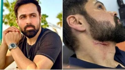 Emraan Hashmi Injured: इमरान हाशमी शूटिंगदरम्यान जखमी; ‘आवारापन 2’च्या सेटवर गंभीर दुखापत