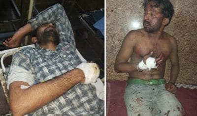 राजधानी में धारा 144, इधर युवक को घेरकर मारी गोली, आरोपी बेसुराग