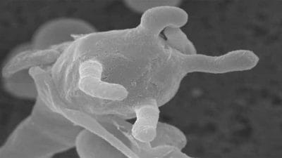 Corona, Black fungus के बाद अब देश में White fungus की एंट्री, 4 मरीज मिलने से मचा हड़कंप