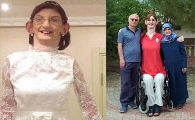 World Tallest Woman : ये है दुनिया की सबसे लंबी महिला, इस वजह से बढ़ी बेहिसाब हाइट!