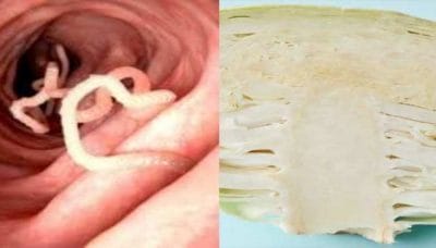 बिना धोई खाई सब्जियों ने मासूम के दिमाग में बनाई आधा किलो की गांठ