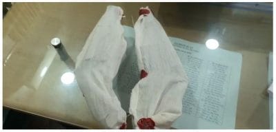 Damoh News: कोतवाली पुलिस ने दो आरोपियों को कट्टा कारतूस के साथ किया गिरफ्तार