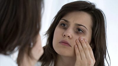 आंखों के नीचे आ गए है डार्क सर्कल तो मत घबराइए, कुछ ही दिनों में इन घरेलू नुस्खों से होंगे दूर