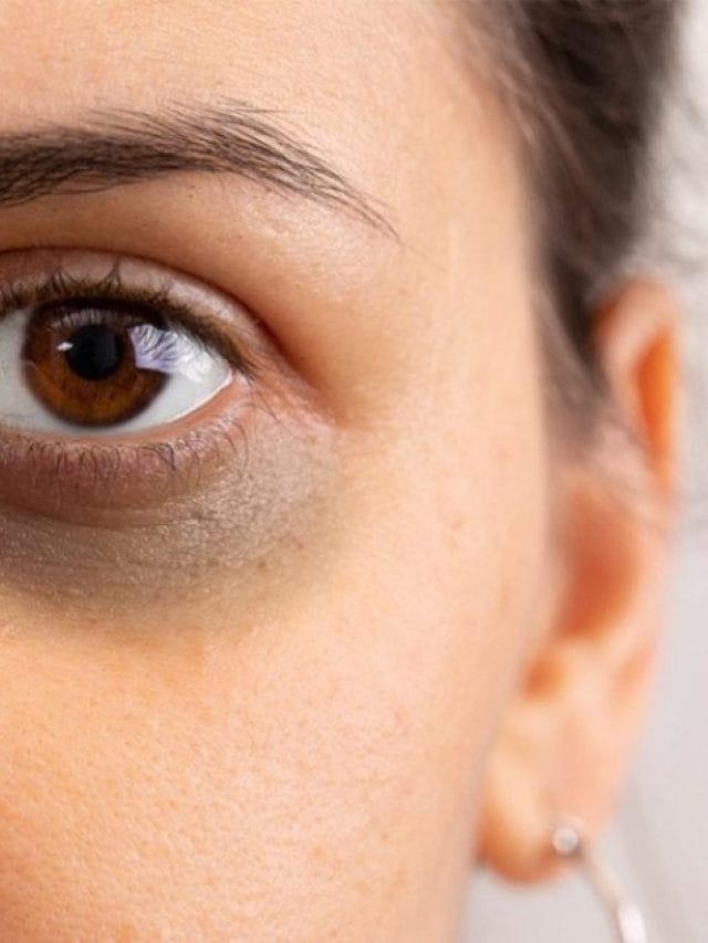 यहां डार्क सर्कल की समस्या के लिए सुपर टिप्स दिए गए हैं