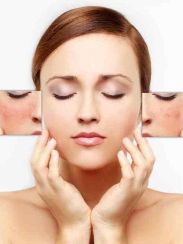 चेहरे के काले धब्बे दूर करेंगे ये 5 घरेलू उपाय