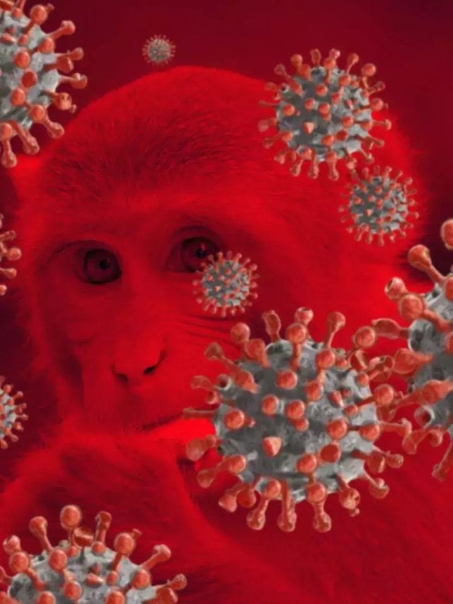 मंकीपॉक्स: वह सब जो आपको जानना आवश्यक है