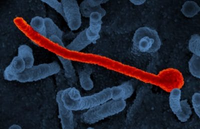 कोरोना और मंकीपॉक्स के बाद Marburg वायरस से बढ़ाई चिंता, WHO ने किया सतर्क, जाने वायरस के लक्षण