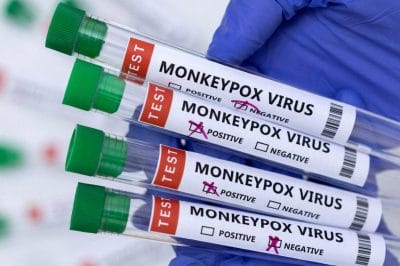 मंकीपॉक्स ने देश की राजधानी में दी दस्तक, सामने आया पहला केस