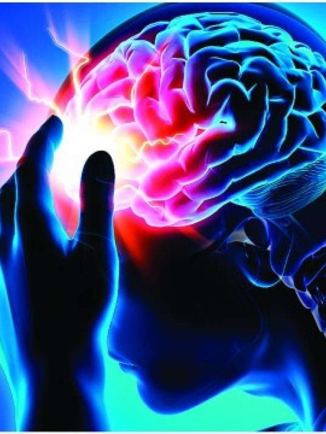 ब्रेन स्ट्रोक क्या है? जानें कारण और लक्षण