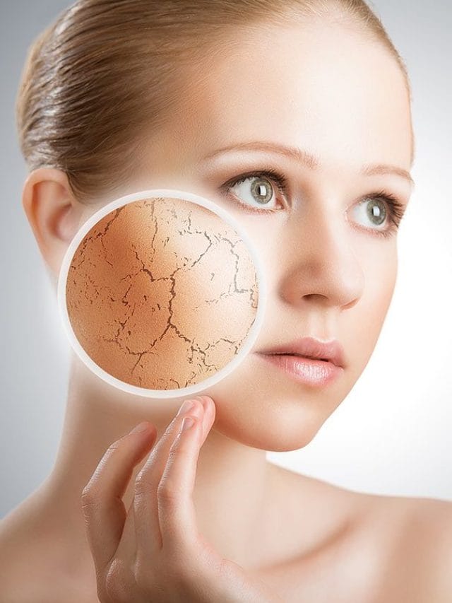 डेड स्किन हटाने के लिए कच्चा दूध का ऐसे  करें इस्तेमाल