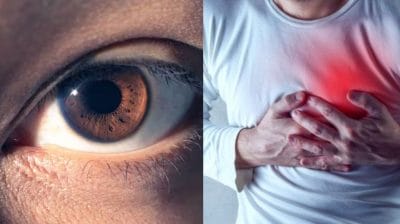 आंखों में दिखने वाली ये परेशानी हो सकती हैं हार्ट अटैक का लक्षण, जानिए क्या हो सकते हैं बदलाव