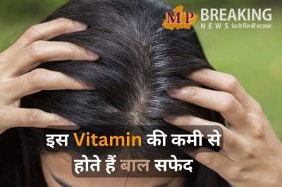 क्या आपके भी कम उम्र में ही होने लगे हैं बाल सफेद, हो सकती है इस विटामिन की कमी, जानें कैसे करें बचाव