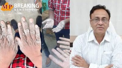 MP News : जानिए शराब फैक्ट्री में बाल श्रम के मामले पर क्या बोले रायसेन कलेक्टर अरविंद दुबे? सोम डिस्टलरी के मालिक पर कब होगी कठोर कार्रवाई? पढ़ें खबर