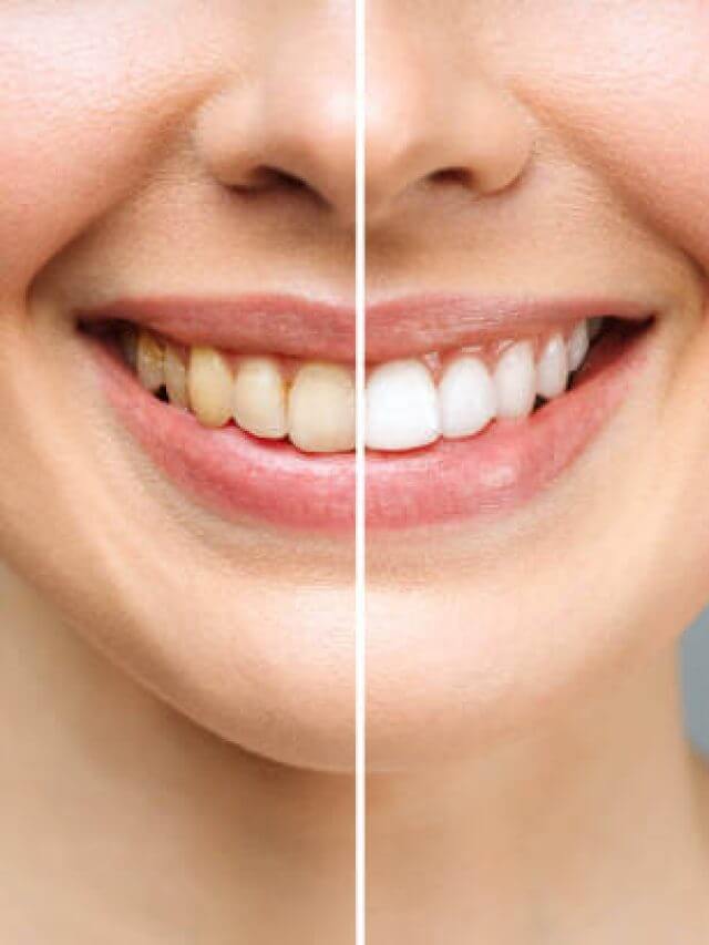 istockphoto-1361598488-612x612