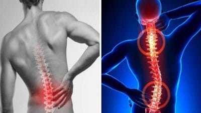 कमर दर्द को न करें नजरअंदाज, जानिए इसके लक्षण और बचाव के उपाय