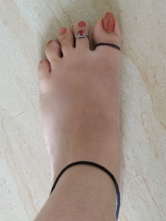 benefits-of-tying-black-thread-on-toe