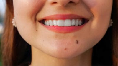 Personality Test: ठुड्डी के तिल में छुपे हैं व्यक्तित्व के गुण, जानें इन लोगों की खासियत