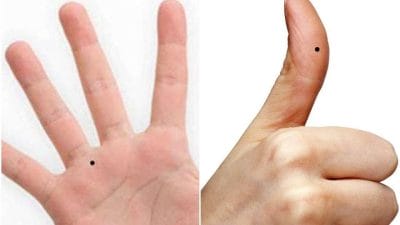व्यक्तित्व के राज खोलेंगे हाथ की उंगलियों के तिल, आसानी से जानें किसी का भी स्वभाव