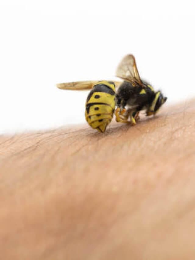 मधुमक्खी के डंक से होने वाले दर्द और सूजन से अब नहीं होगी परेशानी अपनाएं यह असरदार देसी उपाय और पाएँ तुरंत राहत