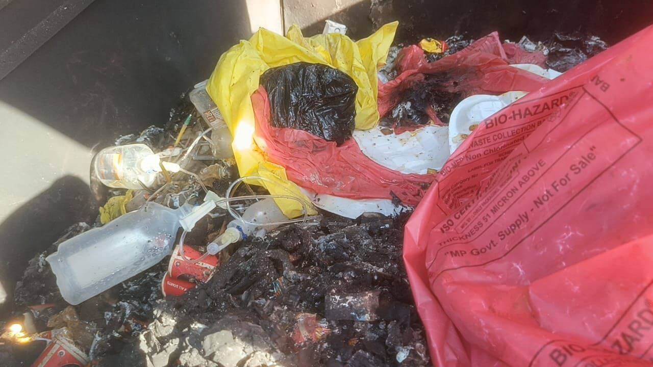 मेडिकल वेस्ट के नाम पर प्राइवेट क्लिनिक्स पर ताले डाल रहा स्वास्थ्य विभाग, सरकारी अस्पताल में खुले में जल रहा कचरा
