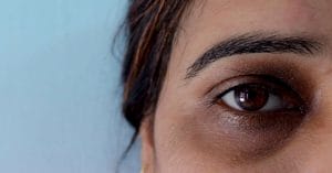आंखों के नीचे दिखते हैं अलग-अलग रंग के घेरे तो न करें नजरअंदाज, हो सकता है ये संकेत!