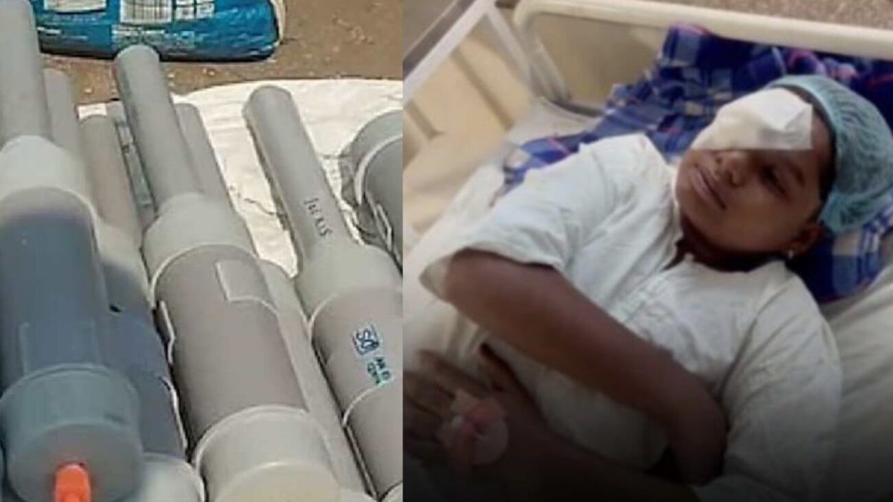 Bhopal news भोपाल में डॉक्टरों की बड़ी सफलता, कार्बाइड गन से घायल 90% मरीज़ स्वस्थ, लगभग सभी को अस्पताल से मिली छुट्टी