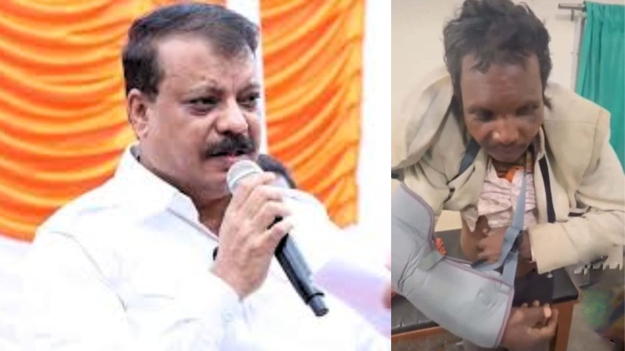 वन कर्मी ने आदिवासी युवक से की मारपीट, आई गंभीर चोट, पुलिस ने नहीं की एफआईआर, उमंग सिंघार का सरकार पर निशाना